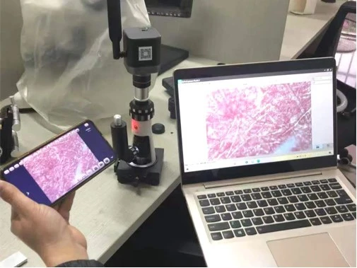 Microscopic Detection Of Non-metallic Inclusions high quality