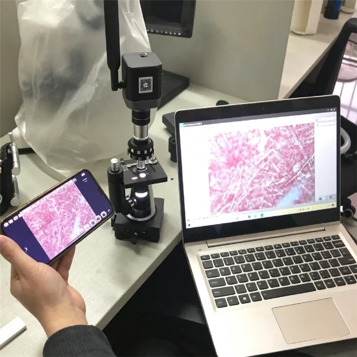 Microscopic Detection Of Non-metallic Inclusions
