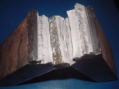 Fracture Detection